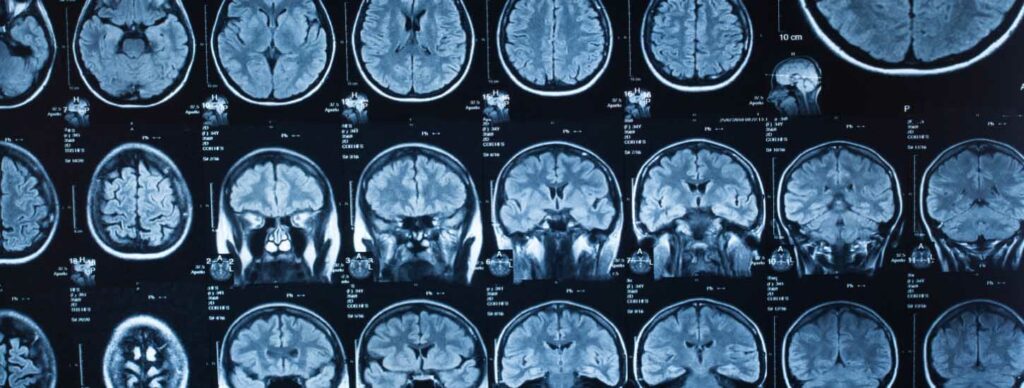 ct-scan-brain-and-head-injury-claims-in-texas